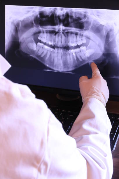Best Emergency Wisdom Teeth Removal in Ilco, WA